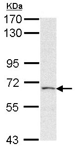 Western blot - Anti-PAPSS2 antibody (AB155588), expandable thumbnail