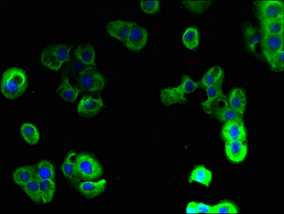 Immunocytochemistry/ Immunofluorescence - Anti-PAQR5 antibody (AB236798)