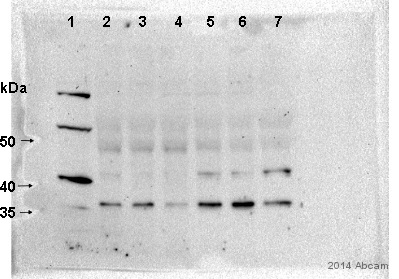 Western blot - Anti-PAQR5 antibody (AB79517)