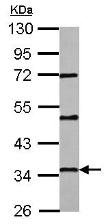 Western blot - Anti-PAQR6 antibody (AB155221)