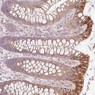 Immunohistochemistry (Formalin/PFA-fixed paraffin-embedded sections) - Anti-PAQR9 antibody (AB185466)