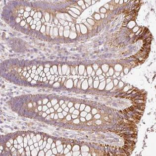 Immunohistochemistry (Formalin/PFA-fixed paraffin-embedded sections) - Anti-PAQR9 antibody (AB185466)