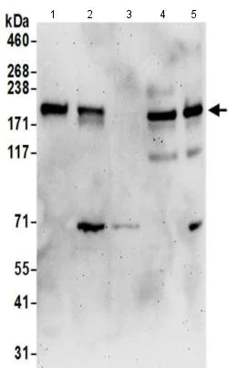 Western blot - Anti-PAR-3/PARD3 antibody (AB191204)