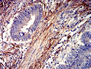 Immunohistochemistry (Formalin/PFA-fixed paraffin-embedded sections) - Anti-PAR1/Thrombin Receptor antibody [5E2E6] (AB233741)