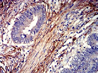 Immunohistochemistry (Formalin/PFA-fixed paraffin-embedded sections) - Anti-PAR1/Thrombin Receptor antibody [5E2E6] (AB233741)