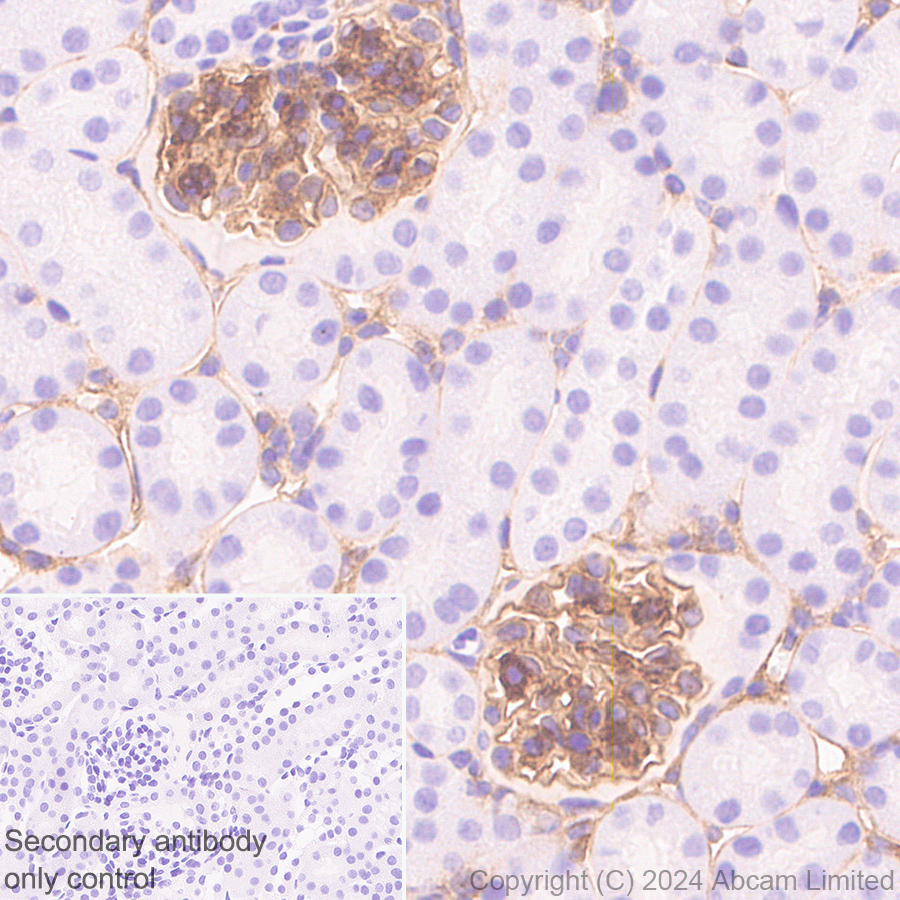 Immunohistochemistry (Formalin/PFA-fixed paraffin-embedded sections) - Anti-PAR1/Thrombin Receptor antibody [EPR28398-8] (ab322457), expandable thumbnail