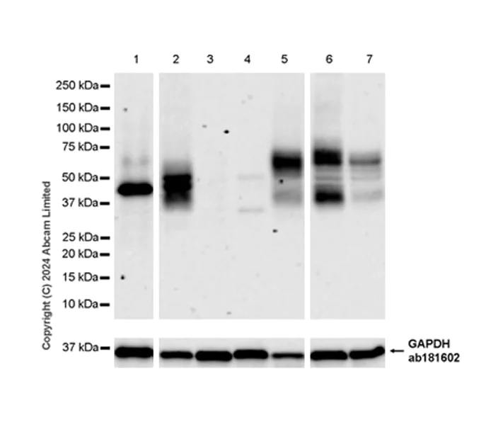 Western blot - Anti-PAR1/Thrombin Receptor antibody [EPR28398-8] - BSA and Azide free (AB324834)
