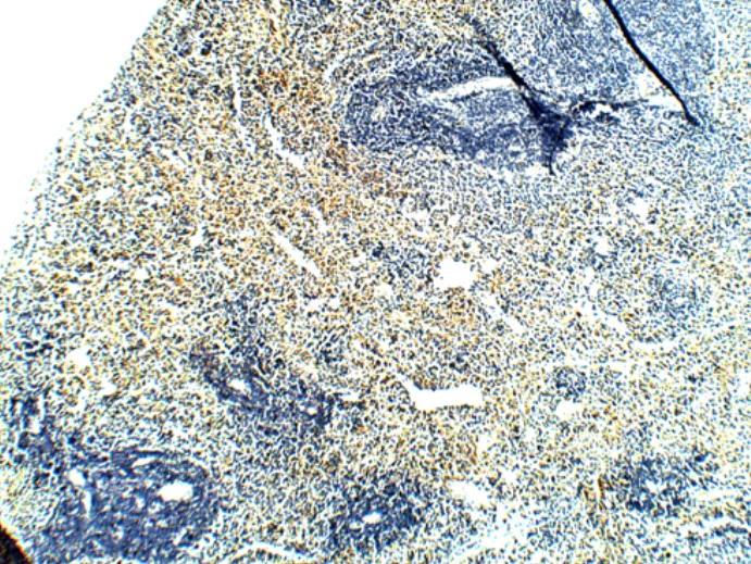 Immunohistochemistry (Formalin/PFA-fixed paraffin-embedded sections) - Anti-PAR2 antibody (AB124227)