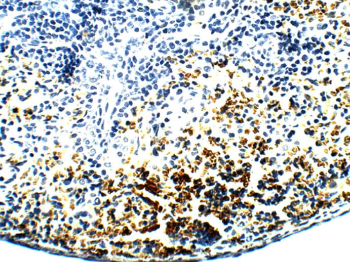 Immunohistochemistry (Formalin/PFA-fixed paraffin-embedded sections) - Anti-PAR2 antibody (AB124227)