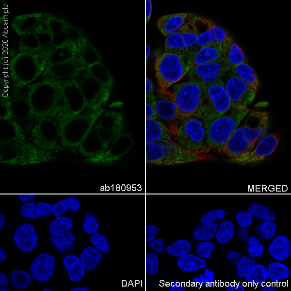 Immunocytochemistry/ Immunofluorescence - Anti-PAR2 antibody [EPR13675] (AB180953), expandable thumbnail