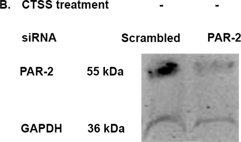 Western blot - Anti-PAR2 antibody [EPR13675] (AB180953)