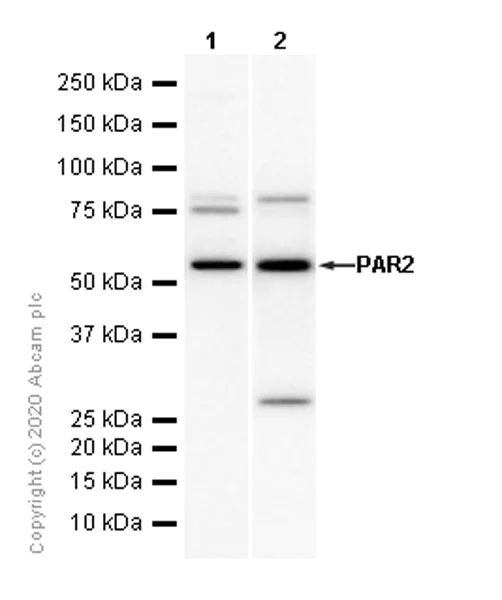 Western blot - Anti-PAR2 antibody [EPR13675] - BSA and Azide free (AB240232)