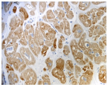Immunohistochemistry (Formalin/PFA-fixed paraffin-embedded sections) - Anti-PAR2 antibody [SAM11] (AB184673)