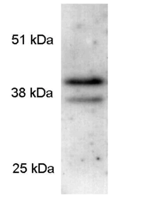 Western blot - Anti-PAR4 antibody (AB5787)