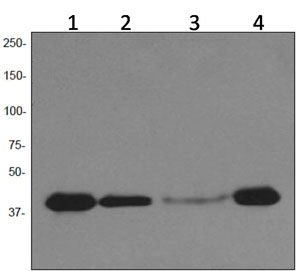 Western blot - Anti-PAR4 antibody [EPR3991] (AB92590)