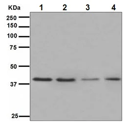 Western blot - Anti-PAR4 antibody [EPR3992] (AB109174)