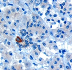 Immunohistochemistry (Formalin/PFA-fixed paraffin-embedded sections) - Anti-PAR6 antibody (AB6022)