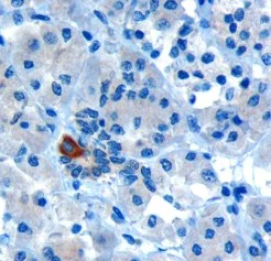 Immunohistochemistry (Formalin/PFA-fixed paraffin-embedded sections) - Anti-PAR6 antibody (AB6022)