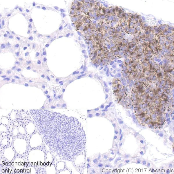 Immunohistochemistry (Formalin/PFA-fixed paraffin-embedded sections) - Anti-Parathyroid Hormone antibody [EPR20598] (AB213557)