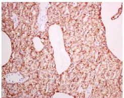 Immunohistochemistry (Formalin/PFA-fixed paraffin-embedded sections) - Anti-Parathyroid Hormone antibody [EPR8480] (AB166631)