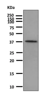 Western blot - Anti-Parathyroid Hormone antibody [EPR8480] (AB166631)