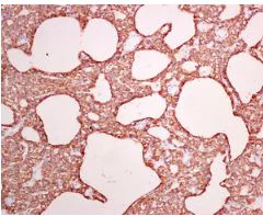 Immunohistochemistry (Formalin/PFA-fixed paraffin-embedded sections) - Anti-Parathyroid Hormone antibody [EPR8481] (AB166632)
