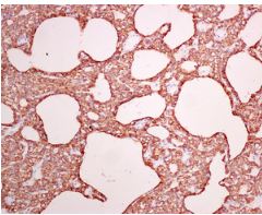 Immunohistochemistry (Formalin/PFA-fixed paraffin-embedded sections) - Anti-Parathyroid Hormone antibody [EPR8481] - BSA and Azide free (AB221666)