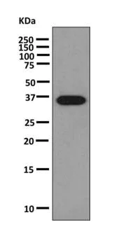 Western blot - Anti-Parathyroid Hormone antibody [EPR8481] - BSA and Azide free (AB221666)