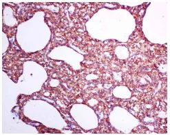 Immunohistochemistry (Formalin/PFA-fixed paraffin-embedded sections) - Anti-Parathyroid Hormone antibody [EPR9939] (AB154792)