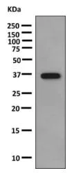 Western blot - Anti-Parathyroid Hormone antibody [EPR9939] - BSA and Azide free (AB221800)