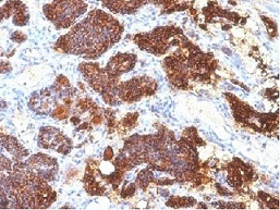 Immunohistochemistry (Formalin/PFA-fixed paraffin-embedded sections) - Anti-Parathyroid Hormone antibody [PTH/1175] - C-terminal (AB215856)