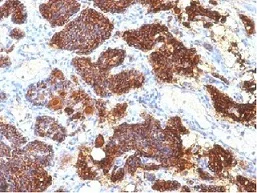 Immunohistochemistry (Formalin/PFA-fixed paraffin-embedded sections) - Anti-Parathyroid Hormone antibody [PTH/1175] - C-terminal (AB215856)