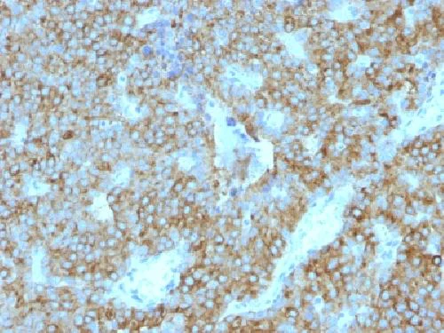 Immunohistochemistry (Formalin/PFA-fixed paraffin-embedded sections) - Anti-Parathyroid Hormone antibody [PTH/1175] - C-terminal (AB215856)