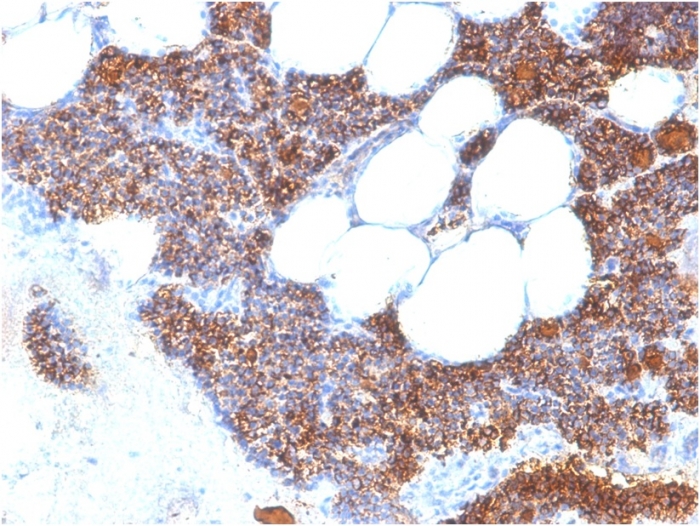 Immunohistochemistry (Formalin/PFA-fixed paraffin-embedded sections) - Anti-Parathyroid Hormone antibody [PTH/2295R] (AB268111), expandable thumbnail