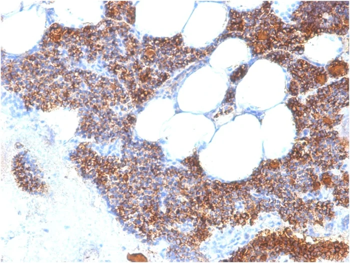 Immunohistochemistry (Formalin/PFA-fixed paraffin-embedded sections) - Anti-Parathyroid Hormone antibody [PTH/2295R] - BSA and Azide free (AB268232)