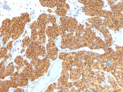 Immunohistochemistry (Formalin/PFA-fixed paraffin-embedded sections) - Anti-Parathyroid Hormone antibody [PTH/911] - N-terminal (AB216041), expandable thumbnail