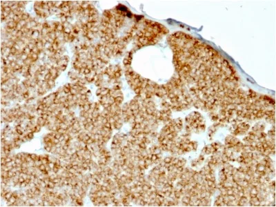 Immunohistochemistry (Formalin/PFA-fixed paraffin-embedded sections) - Anti-Parathyroid Hormone antibody [rPTH/911] (AB234415)