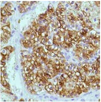 Immunohistochemistry (Formalin/PFA-fixed paraffin-embedded sections) - Anti-Parathyroid Hormone antibody [SP151] (AB130759)