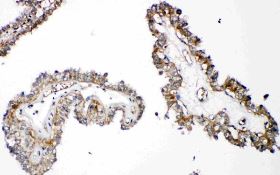 Immunohistochemistry (Formalin/PFA-fixed paraffin-embedded sections) - Anti-Parathyroid Hormone Receptor 1/PTH1R antibody (AB176393), expandable thumbnail
