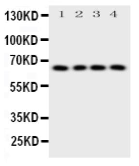Western blot - Anti-Parathyroid Hormone Receptor 1/PTH1R antibody (AB176393), expandable thumbnail