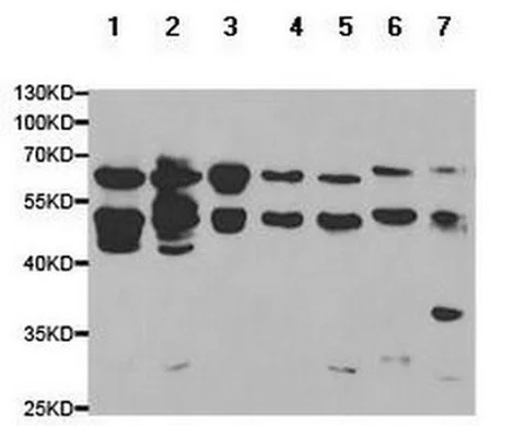 Western blot - Anti-Parathyroid Hormone Receptor 1/PTH1R antibody (AB180762)