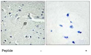Immunohistochemistry (Formalin/PFA-fixed paraffin-embedded sections) - Anti-Parathyroid Hormone Receptor 1/PTH1R antibody (AB75150)