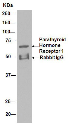 Immunoprecipitation - Anti-Parathyroid Hormone Receptor 1/PTH1R antibody [EPR15892] (AB189924), expandable thumbnail