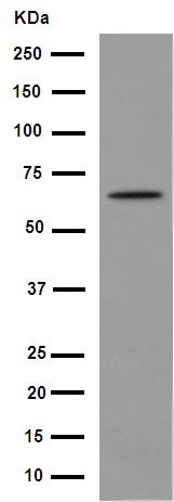 Western blot - Anti-Parathyroid Hormone Receptor 1/PTH1R antibody [EPR15892] (AB189924), expandable thumbnail