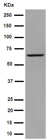 Western blot - Anti-Parathyroid Hormone Receptor 1/PTH1R antibody [EPR15892] (AB189924), expandable thumbnail