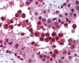 Immunohistochemistry (Formalin/PFA-fixed paraffin-embedded sections) - Anti-PARC antibody (AB115631)