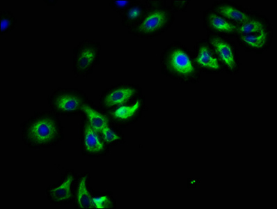 Immunocytochemistry/ Immunofluorescence - Anti-PARD6B antibody (AB234786)