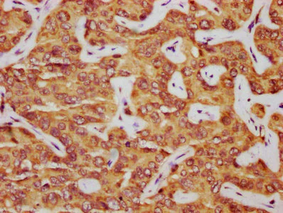 Immunohistochemistry (Formalin/PFA-fixed paraffin-embedded sections) - Anti-PARD6B antibody (AB234786)