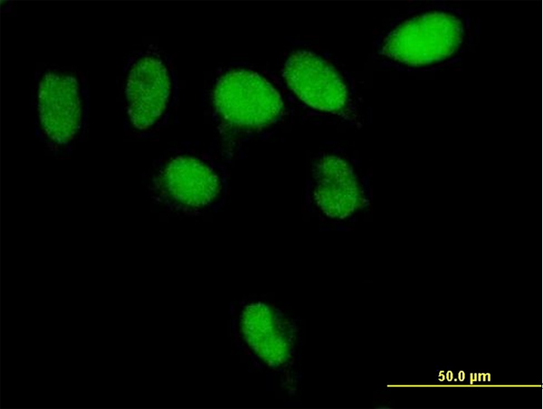 Immunocytochemistry/ Immunofluorescence - Anti-PARG antibody (AB169639), expandable thumbnail