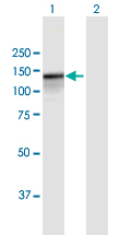 Western blot - Anti-PARG antibody (AB169639), expandable thumbnail